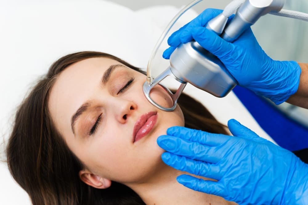Laser Treatments