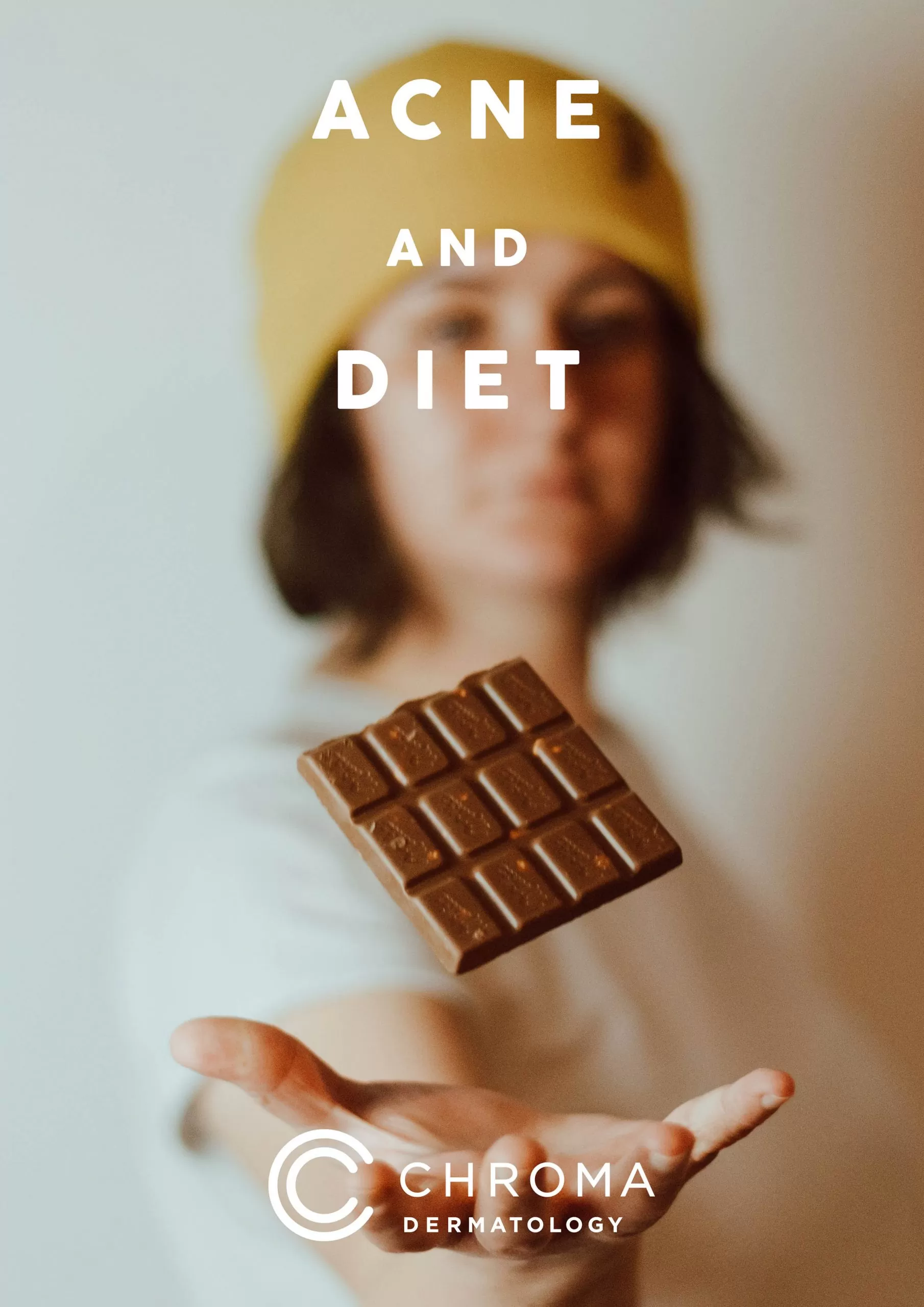 Acne And Chocolate On Diet