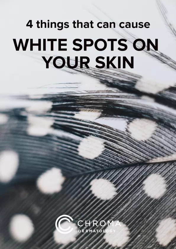 White Spots On Skin