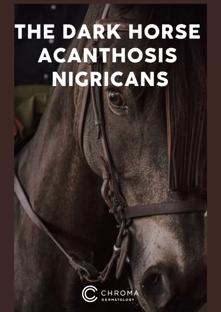 Dark Horse Acanthosis Nigricans