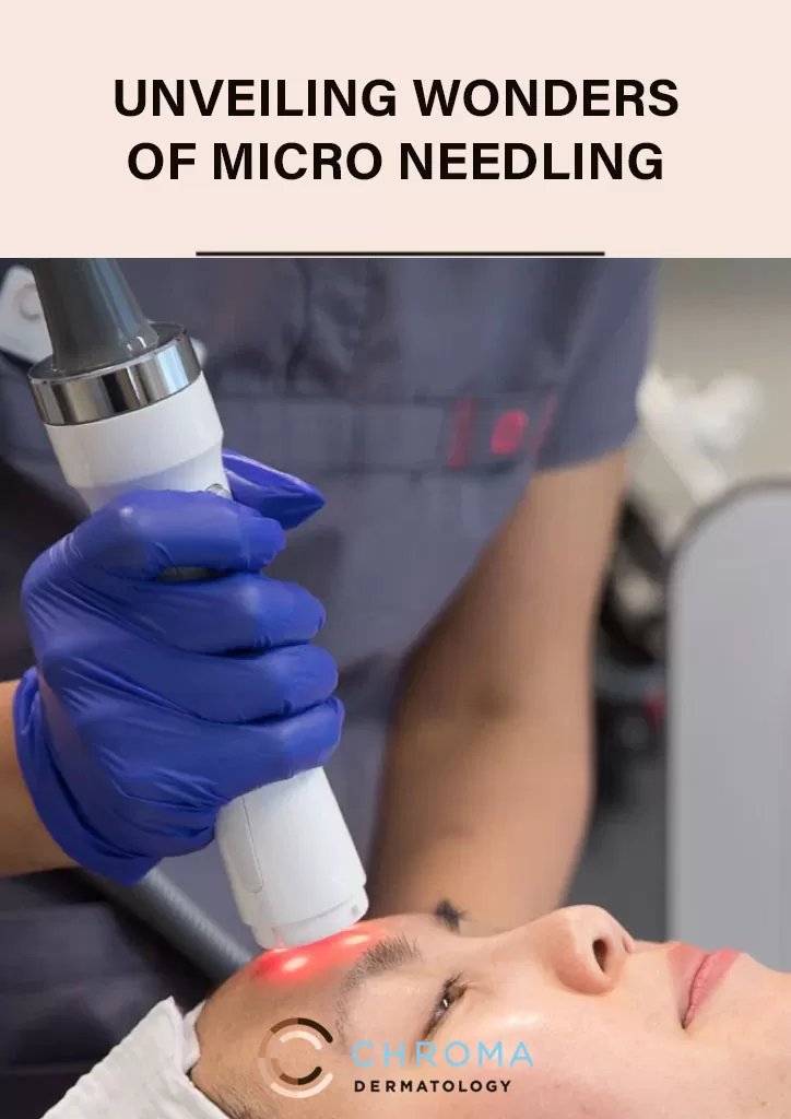Microneedling For Skin Rejuvenation